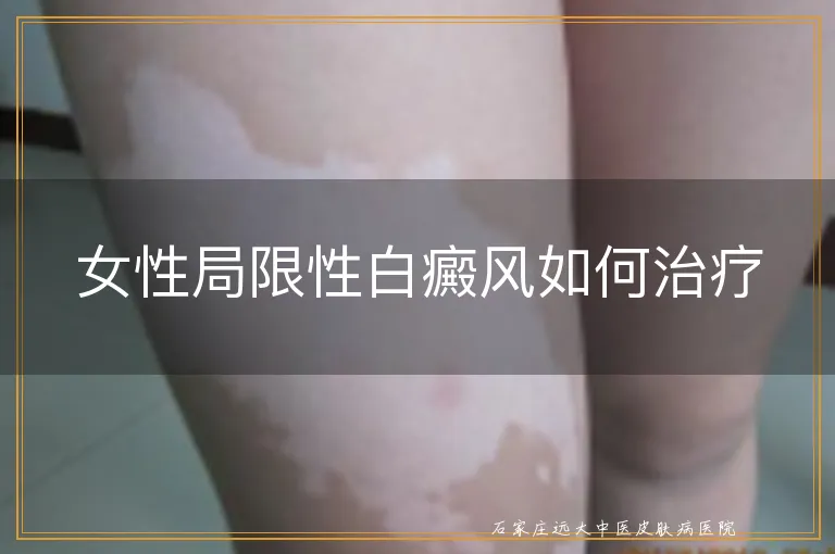 女性局限性白癜风如何治疗