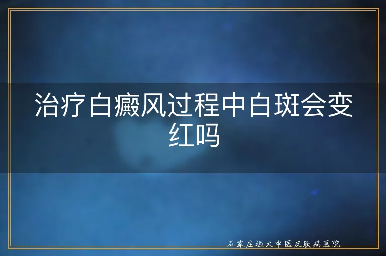 治疗白癜风过程中白斑会变红吗