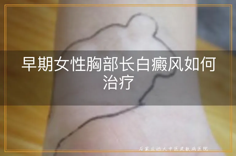 早期女性胸部长白癜风如何治疗