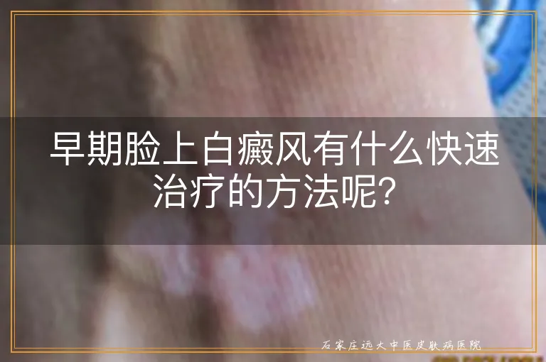 早期脸上白癜风有什么快速治疗的方法呢？