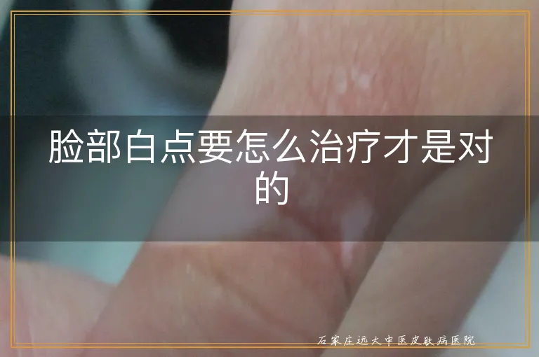 脸部白点要怎么治疗才是对的