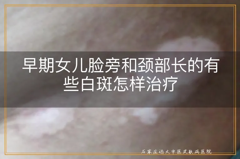 早期女儿脸旁和颈部长的有些白斑怎样治疗