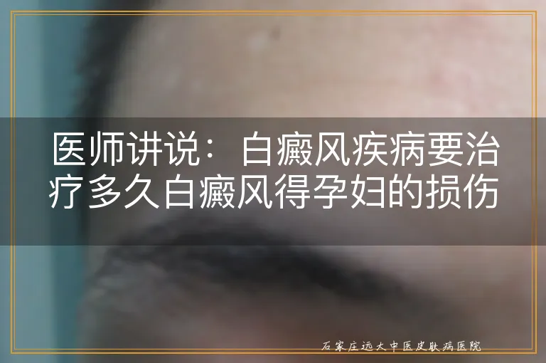 医师讲说：白癜风疾病要治疗多久白癜风得孕妇的损伤有哪些治疗白癜风