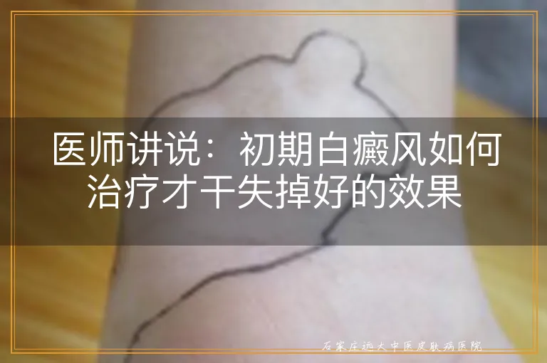 医师讲说：初期白癜风如何治疗才干失掉好的效果