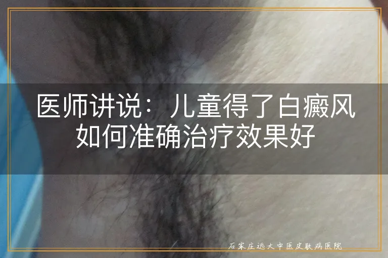 医师讲说：儿童得了白癜风如何准确治疗效果好