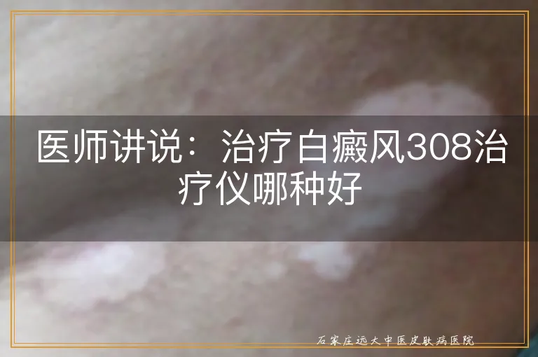 医师讲说：治疗白癜风308治疗仪哪种好