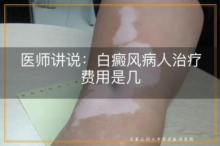 医师讲说：白癜风病人治疗费用是几