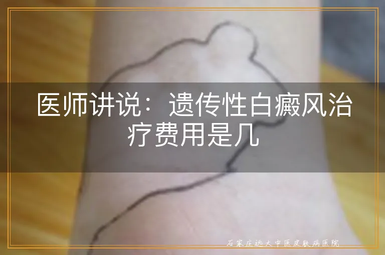 医师讲说：遗传性白癜风治疗费用是几