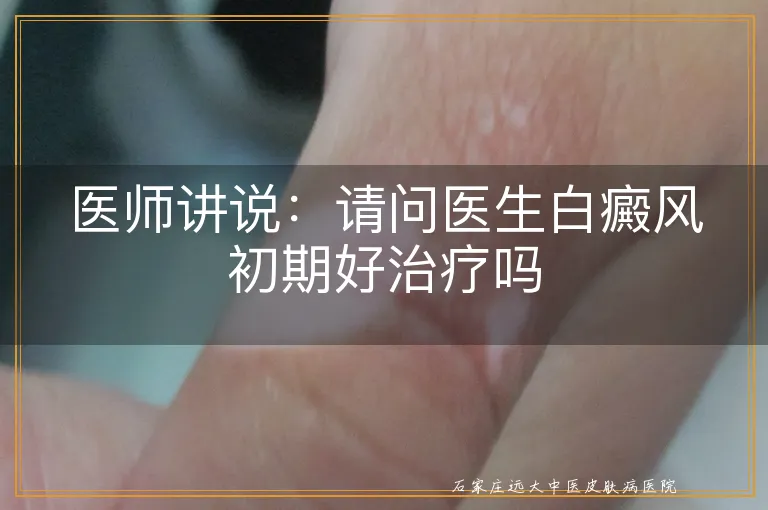 医师讲说：请问医生白癜风初期好治疗吗