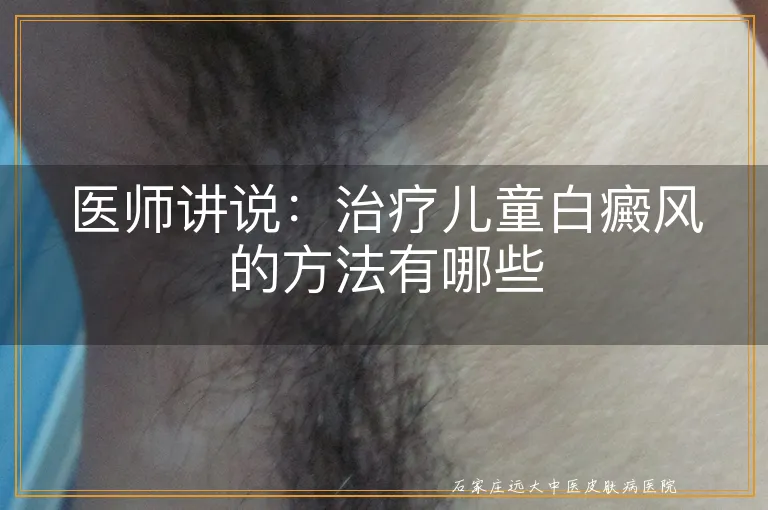 医师讲说：治疗儿童白癜风的方法有哪些