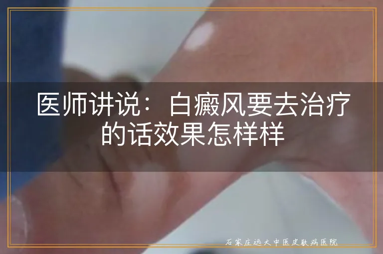 医师讲说：白癜风要去治疗的话效果怎样样