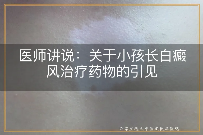 医师讲说：关于小孩长白癜风治疗药物的引见