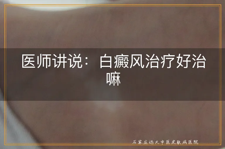 医师讲说：白癜风治疗好治嘛