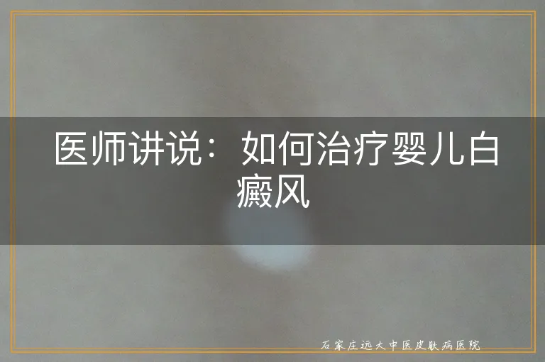 医师讲说：如何治疗婴儿白癜风