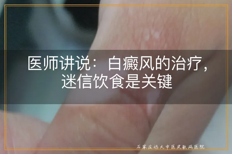 医师讲说：白癜风的治疗，迷信饮食是关键