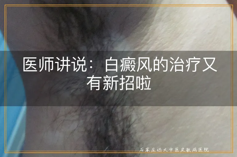 医师讲说：白癜风的治疗又有新招啦