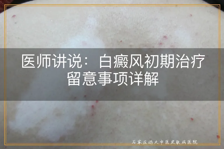 医师讲说：白癜风初期治疗留意事项详解