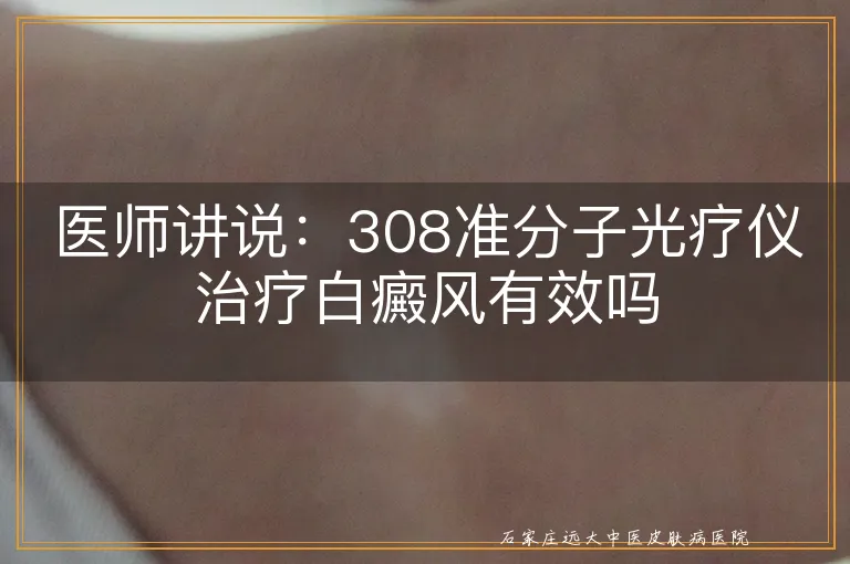 医师讲说：308准分子光疗仪治疗白癜风有效吗