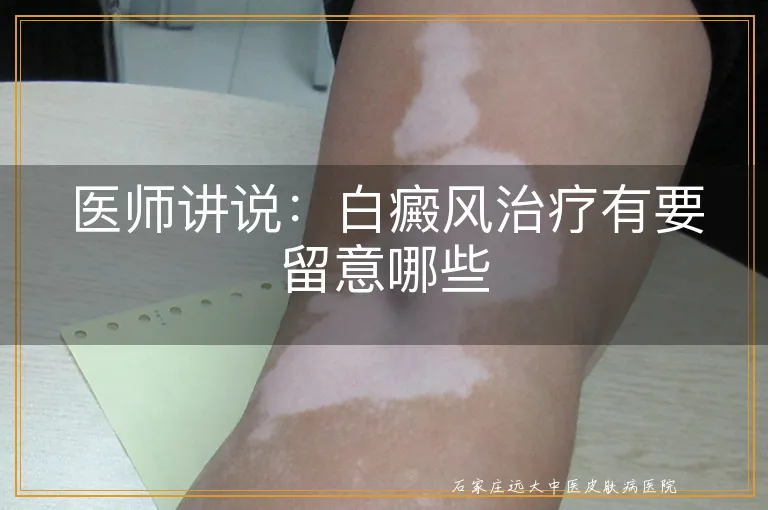 医师讲说：白癜风治疗有要留意哪些