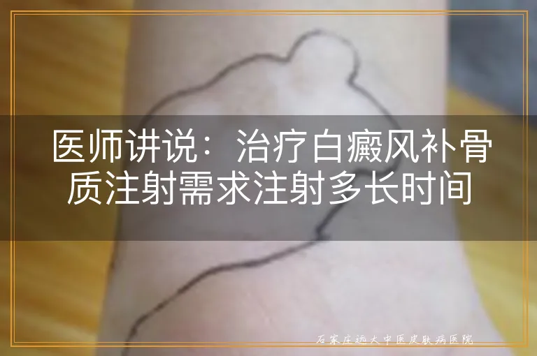 医师讲说：治疗白癜风补骨质注射需求注射多长时间