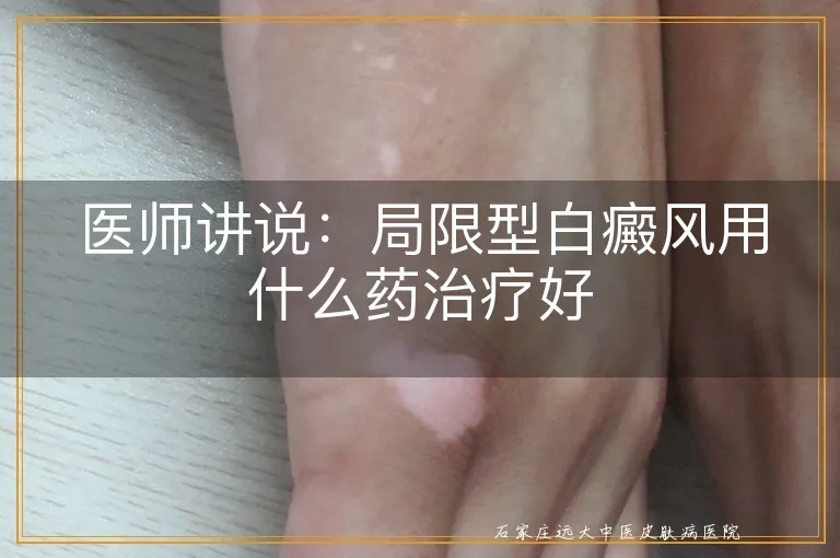 医师讲说：局限型白癜风用什么药治疗好