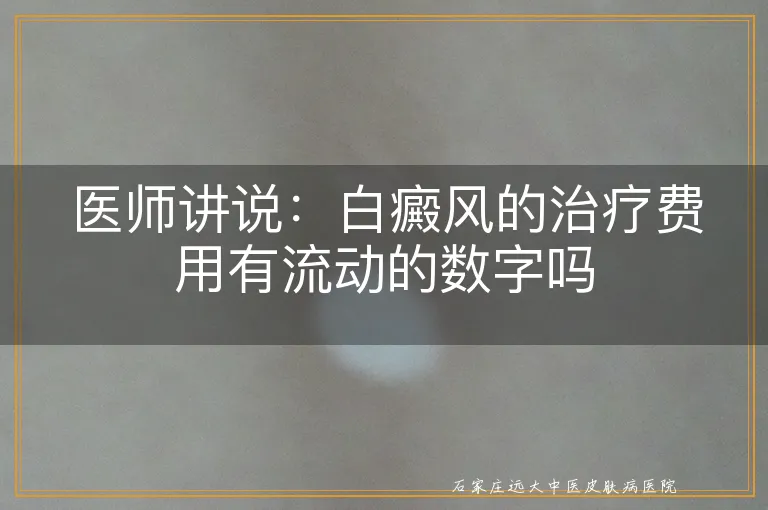 医师讲说：白癜风的治疗费用有流动的数字吗