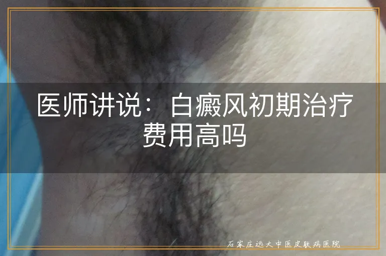 医师讲说：白癜风初期治疗费用高吗