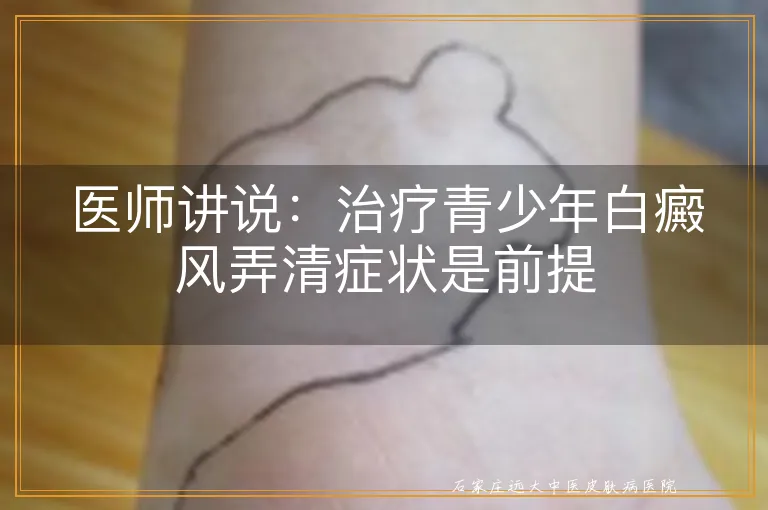 医师讲说：治疗青少年白癜风弄清症状是前提