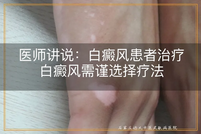 医师讲说：白癜风患者治疗白癜风需谨选择疗法