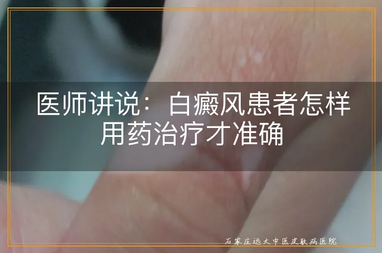 医师讲说：白癜风患者怎样用药治疗才准确