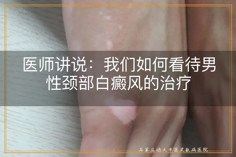 医师讲说：我们如何看待男性颈部白癜风的治疗