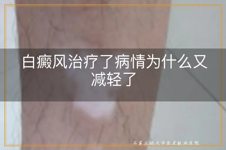 白癜风治疗了病情为什么又减轻了