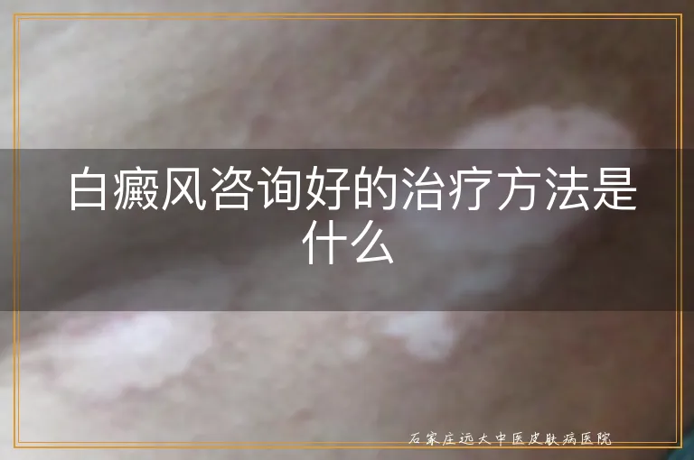 白癜风咨询好的治疗方法是什么