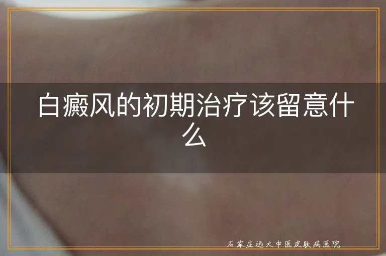 白癜风的初期治疗该留意什么