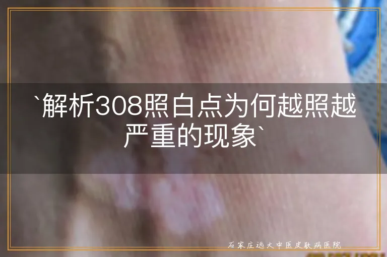 `解析308照白点为何越照越严重的现象`