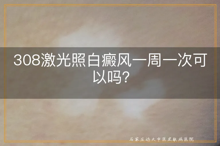 308激光照白癜风一周一次可以吗？