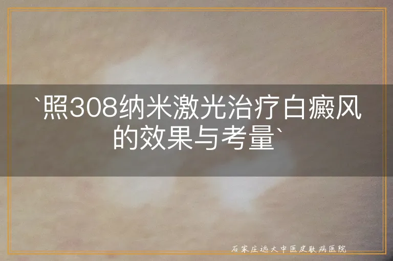 `照308纳米激光治疗白癜风的效果与考量`