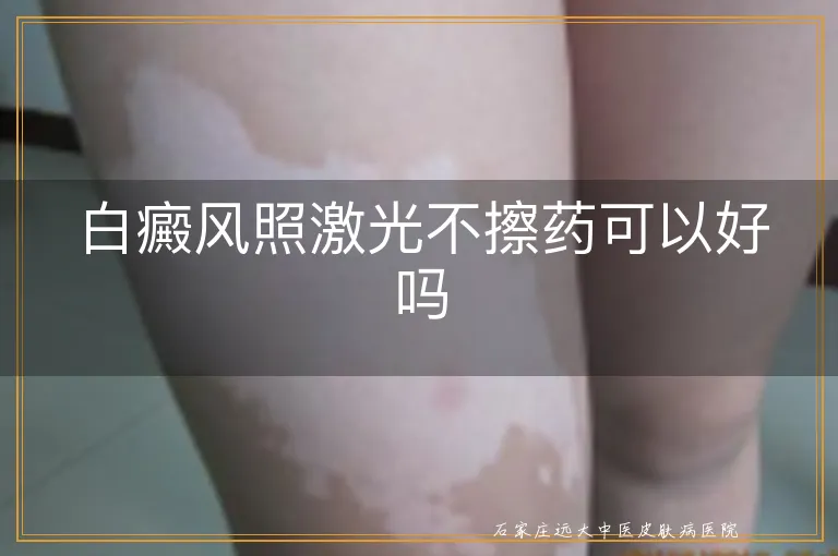 白癜风照激光不擦药可以好吗