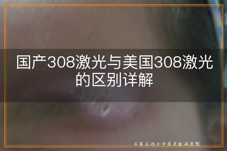 国产308激光与美国308激光的区别详解