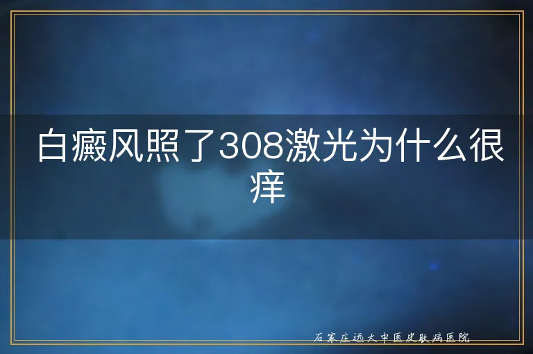 白癜风照了308激光为什么很痒