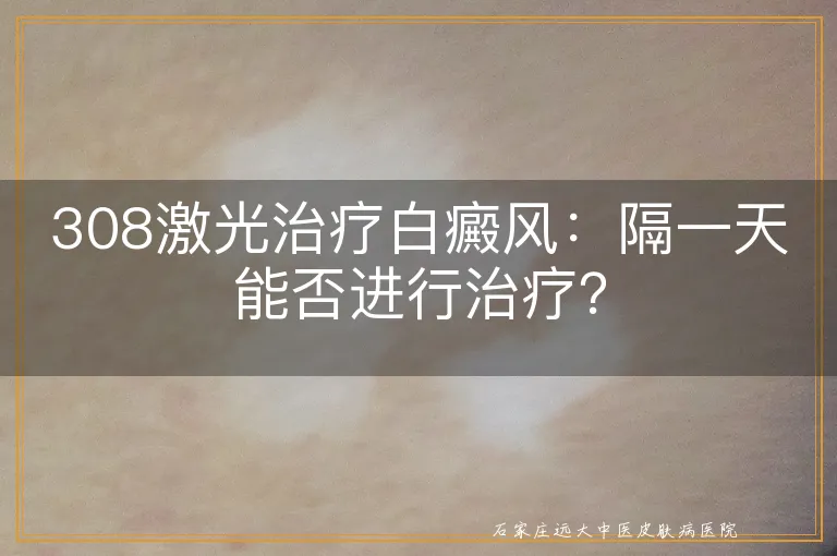 308激光治疗白癜风：隔一天能否进行治疗？