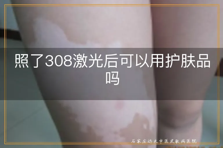 照了308激光后可以用护肤品吗