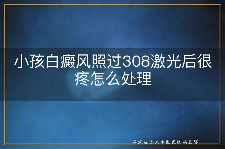 小孩白癜风照过308激光后很疼怎么处理