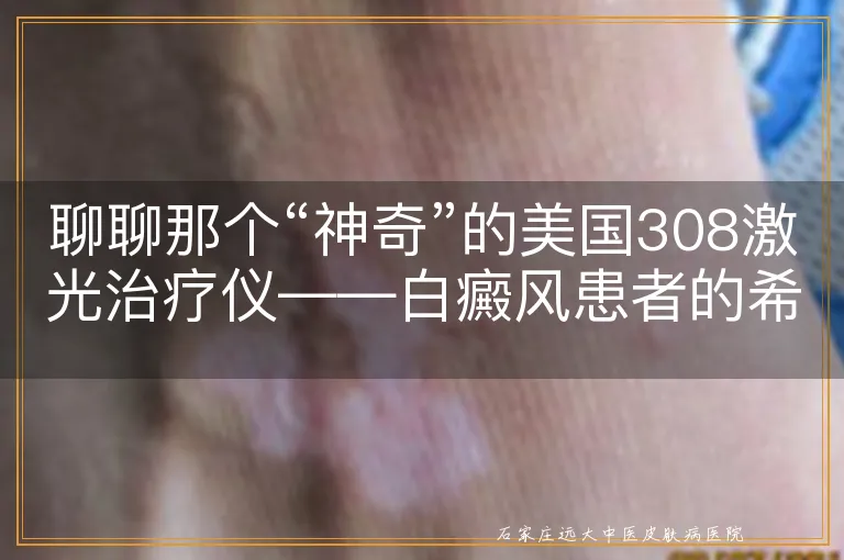 聊聊那个“神奇”的美国308激光治疗仪——白癜风患者的希望之光