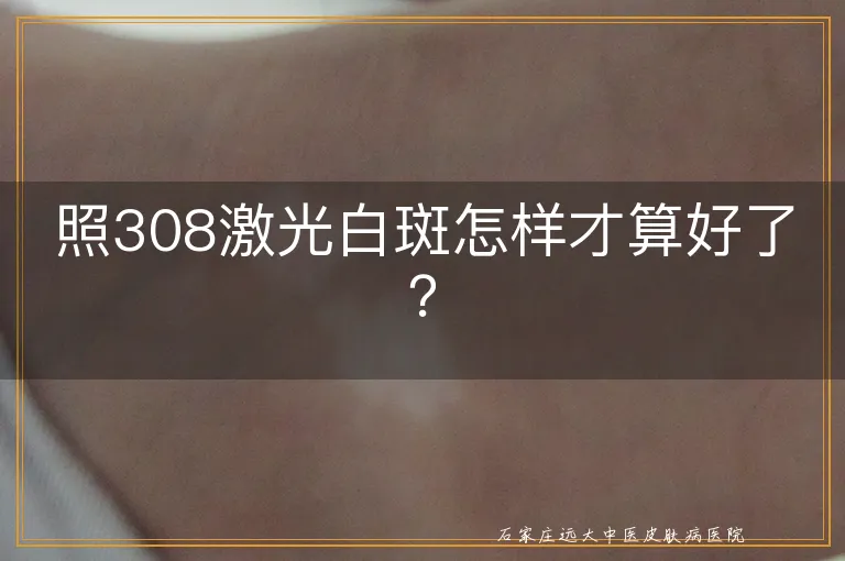 照308激光白斑怎样才算好了？