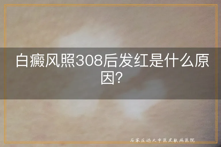 白癜风照308后发红是什么原因？