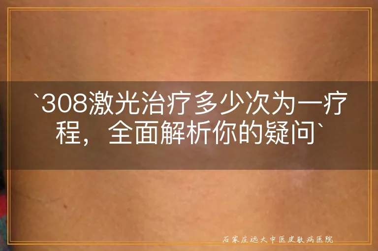 `308激光治疗多少次为一疗程，全面解析你的疑问`