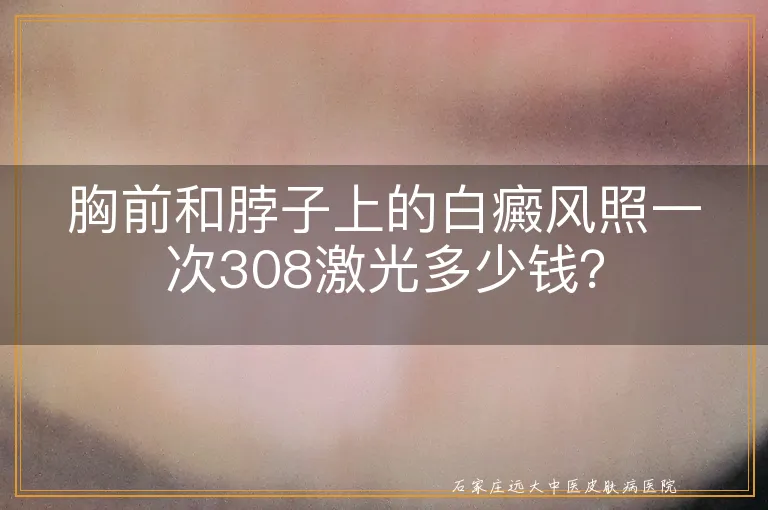 胸前和脖子上的白癜风照一次308激光多少钱？