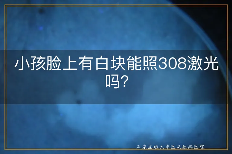 小孩脸上有白块能照308激光吗？