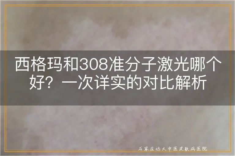 西格玛和308准分子激光哪个好？一次详实的对比解析